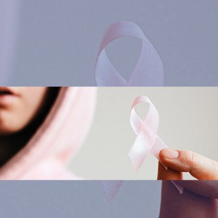 benessere estetica oncologica
